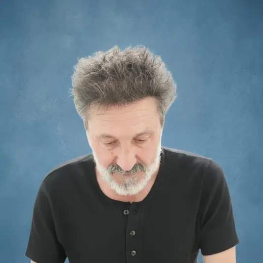 Na haartransplantatie, Augustin Fernández Espinosa