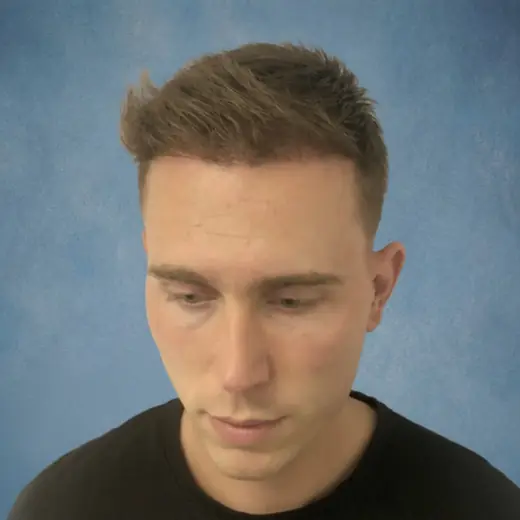 Na haartransplantatie, Clint Ouwendijk