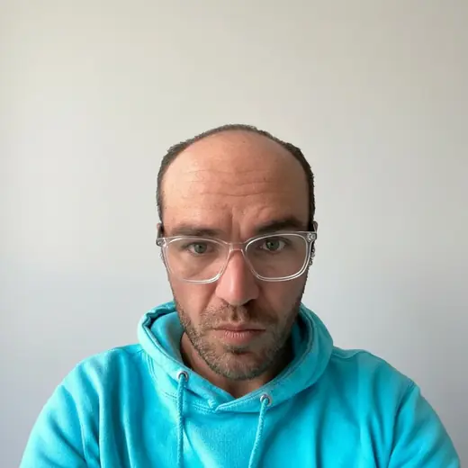 Voor haartransplantatie, Dennis Horvath