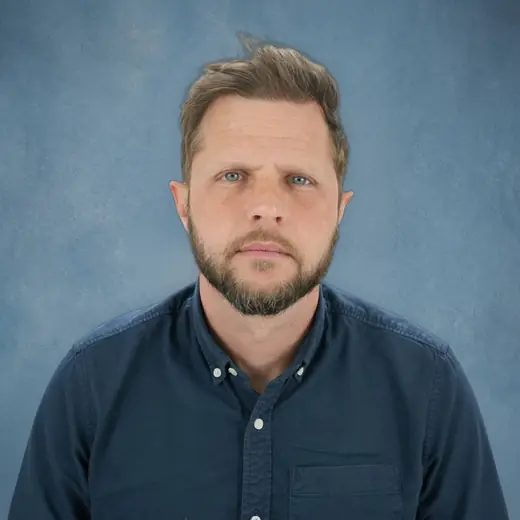 Na haartransplantatie, Dieter Segaert