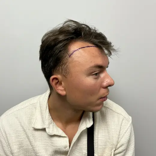 Voor de behandeling, Dion van Drunen