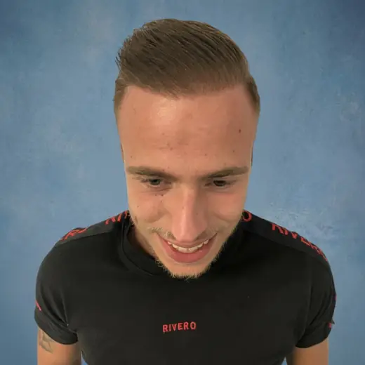 Na haartransplantatie, Dylan