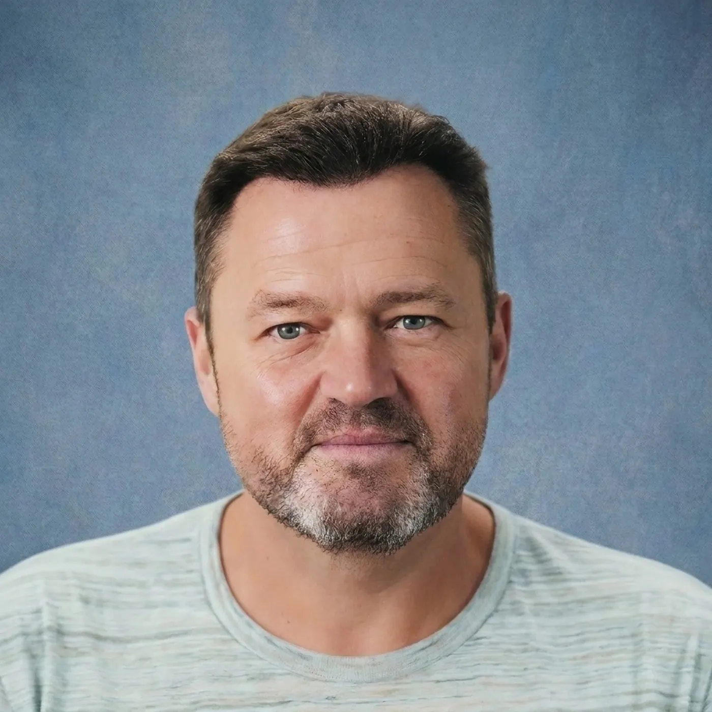 Na de haartransplantatie van Frans Duijts bij GlobalHair Institute