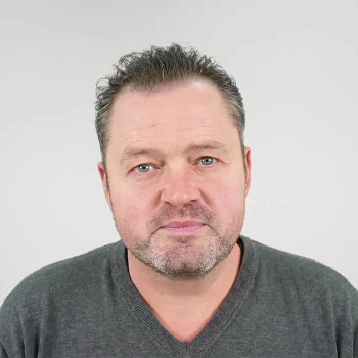 Frans Duijts, voor de haartransplantatie