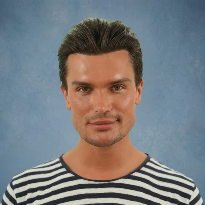 Koen Pieter, na de haartransplantatie