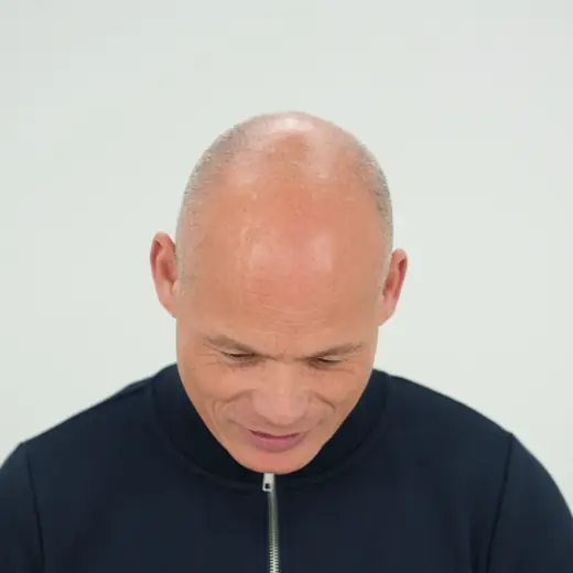 Voor haartransplantatie, Louis Fraanje