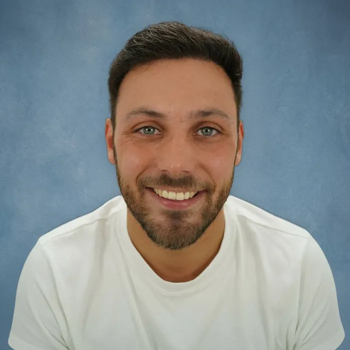 Michael De Maat, na de haartransplantatie