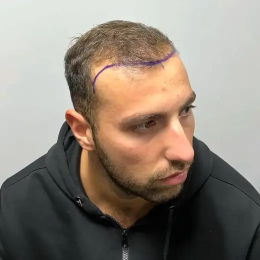 Voor de behandeling, Nikos Chabilomatis