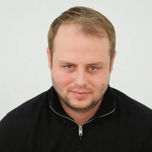 Voor haartransplantatie, Roy De Vrije