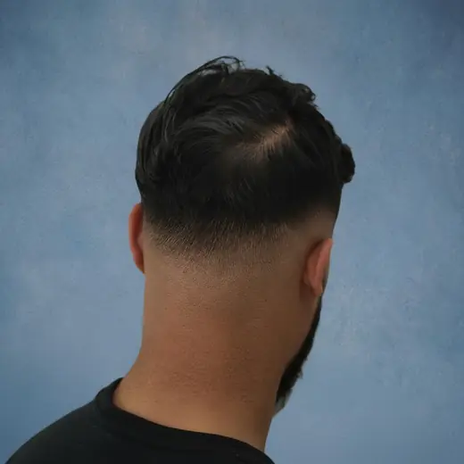 Na haartransplantatie, Cliënt