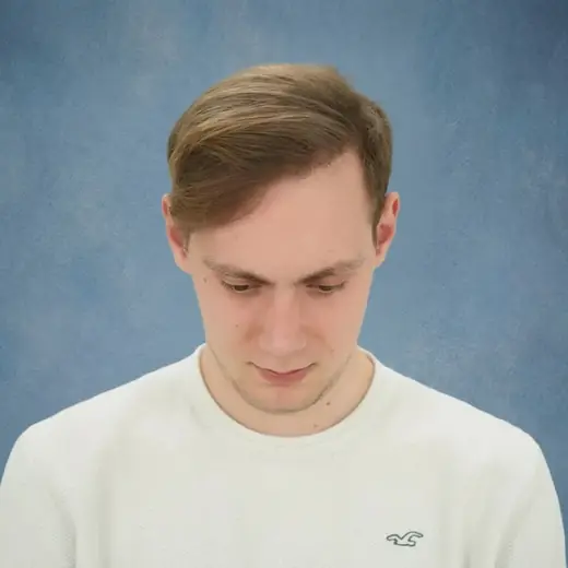Na haartransplantatie, Tjeerd Thuss