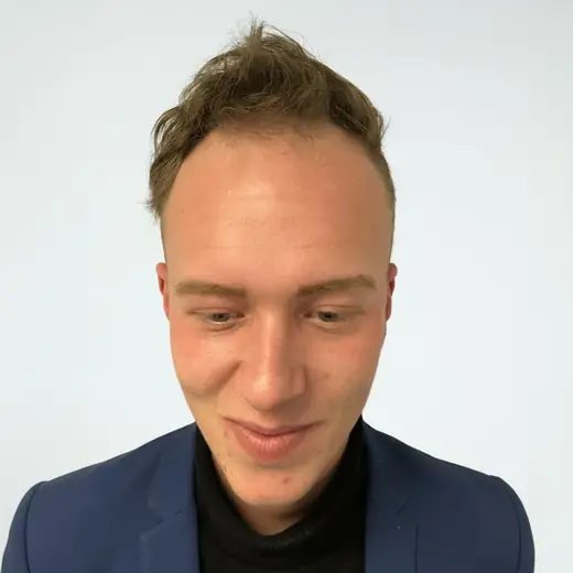 Voor haartransplantatie, Tristan